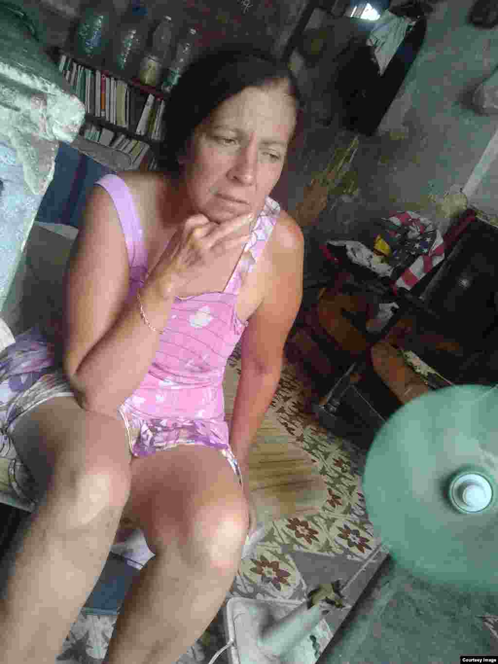 La Dama de Blanco Hortensia Alfonso Vega, de 50 años, todavía se recupera de una operación realizada el 27 de marzo por un cáncer de colon. 